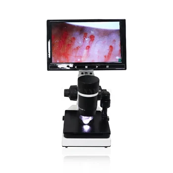 SY-B198 Kliniği LCD Ekran Mikrosirkülasyon Mikroskop Monitör Kılcal Mikroskop